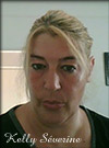Kelly Severine